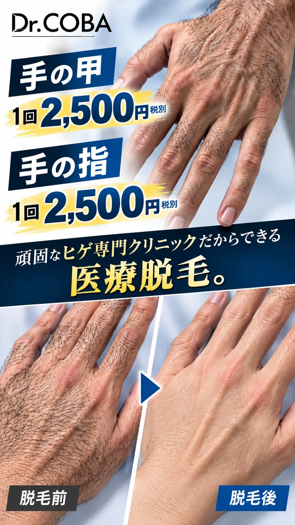 手の甲2500円、手の指2500円